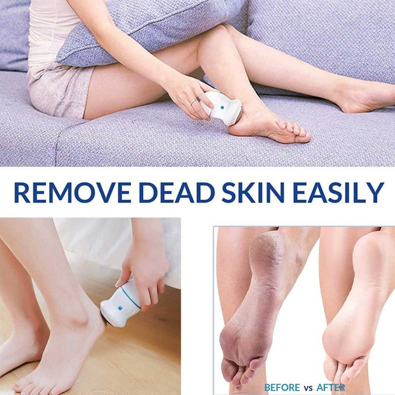Rechargeable Find Back Callus Remover With Built-In Vacuum Foot Grinder Machine Hard Crack Cleaning